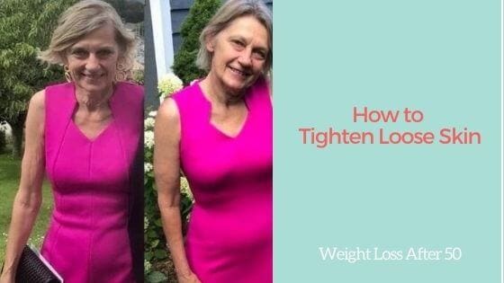 How to Tighten Loose Skin After Losing Weight